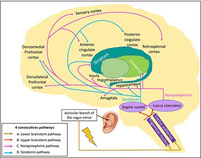 Transcutaneous Auricular Vagal Nerve Stimulation and Disorders of Consciousness: A Hypothesis for Mechanisms of Action